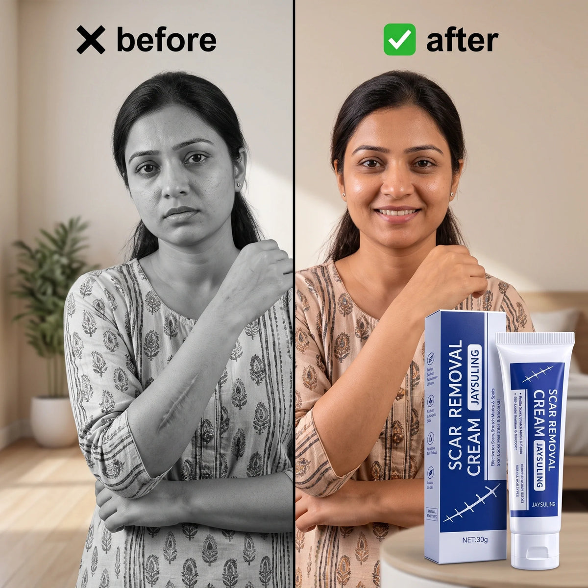 DermaCream™ — Scar Removal Cream  | Keloid & Stretch Mark Care | Softening & Flattening