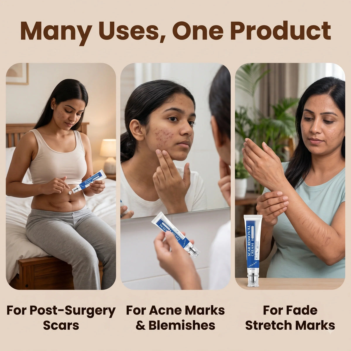 DermaCream™ — Scar Removal Cream  | Keloid & Stretch Mark Care | Softening & Flattening