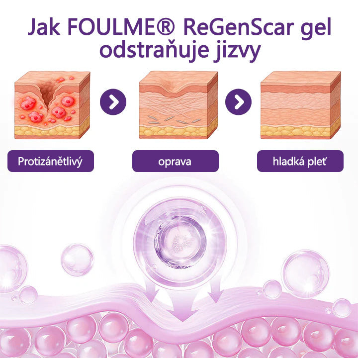 ReGenScar Advanced Scar Repair Gel – Fade Old & New Scars Fast