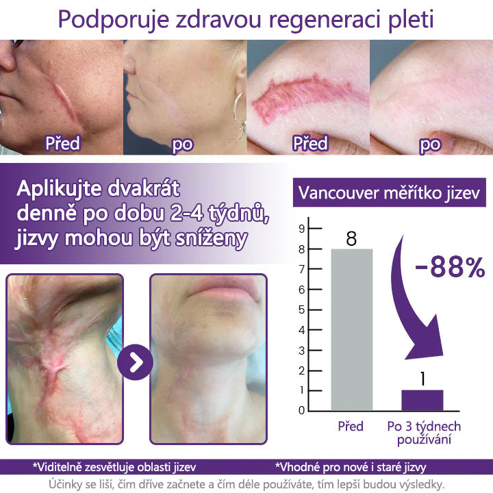 ReGenScar Advanced Scar Repair Gel – Fade Old & New Scars Fast