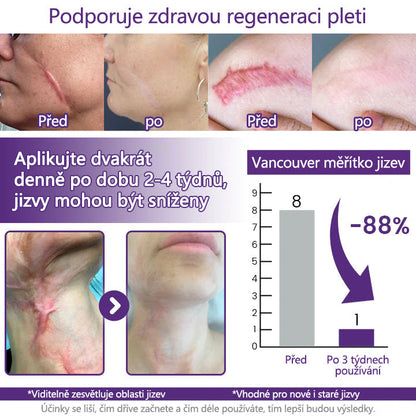 ReGenScar Advanced Scar Repair Gel – Fade Old & New Scars Fast